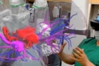 HoloLens Mixed Reality Surgery