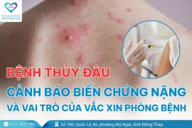 Bệnh thủy đậu: Cảnh báo biến chứng nặng và vai trò của vắc xin phòng bệnh