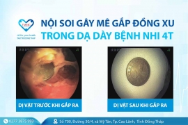 Nội soi gây mê gắp đồng xu trong dạ dày bệnh nhi 4 tuổi