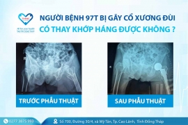 Người bệnh 97 tuổi bị gãy cổ xương đùi có thay khớp háng được không?