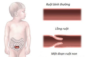 long-ruot-2