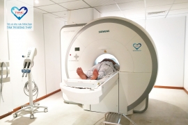 Lợi ích của chụp cộng hưởng từ (MRI) là gì?