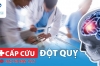 Cấp cứu đột quỵ tại Tâm Trí Đồng Tháp