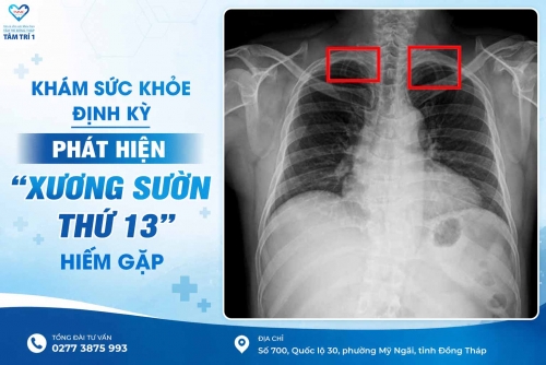 Khám sức khỏe định kỳ - Phát hiện "xương sườn thứ 13" hiếm gặp