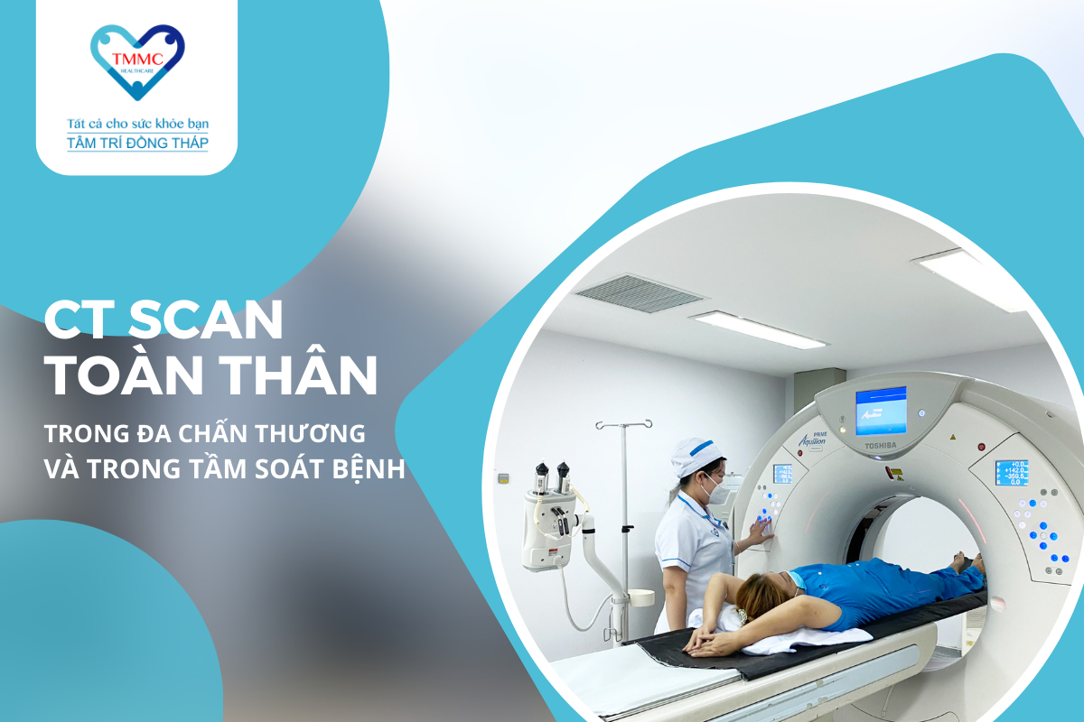 CT Scan toàn thân (WBCT) trong đa chấn thương và tầm soát bệnh