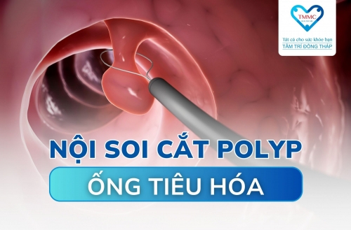Nội soi cắt polyp ống tiêu hóa