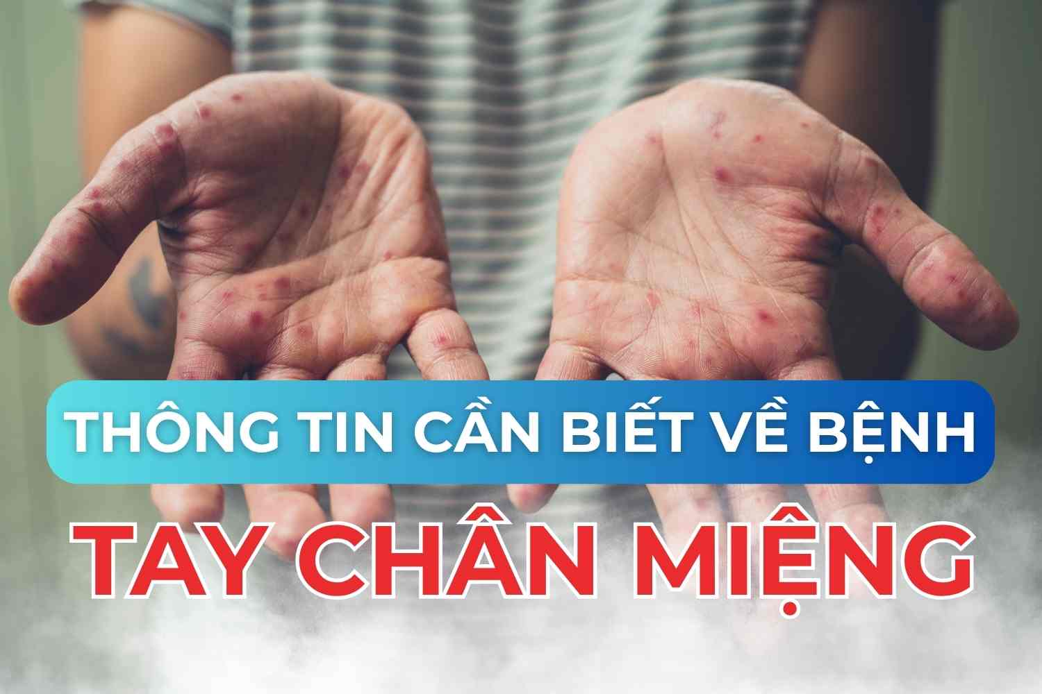 TAY_CHAN_MIYNG_2