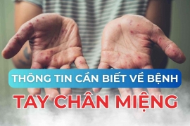 Thông tin cần biết về bệnh tay chân miệng 