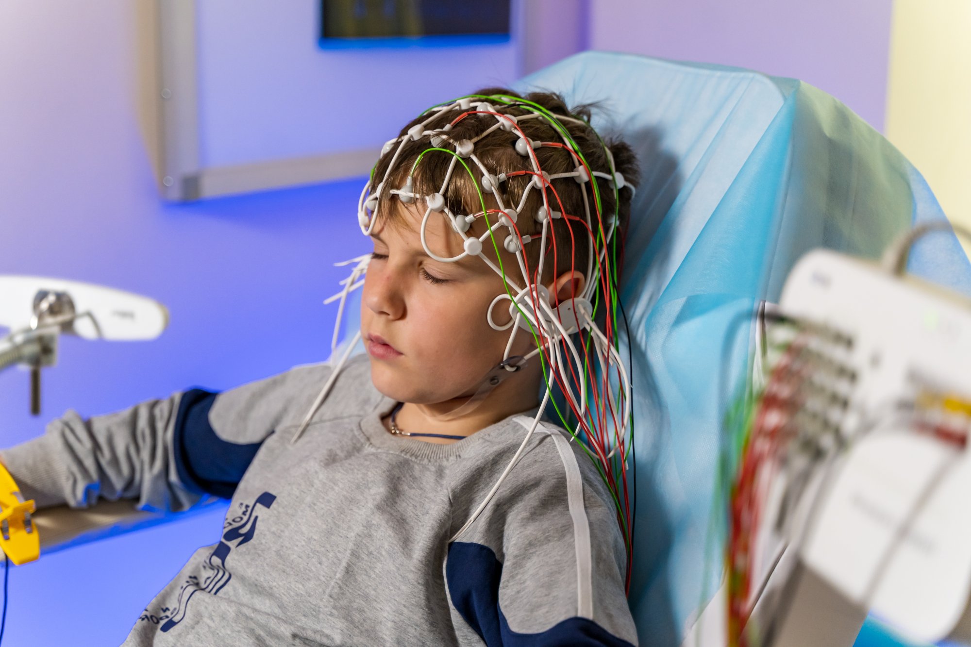Đo điện não đồ - Phương pháp tầm soát bệnh sớm ở não