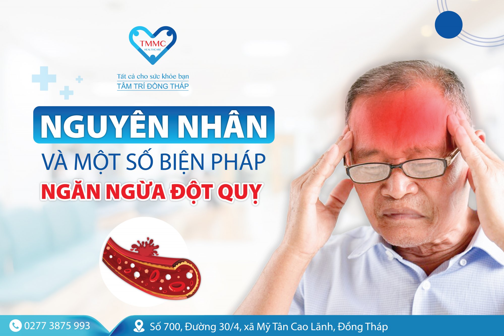 Đột quỵ: Nguyên nhân và phương pháp ngăn ngừa đột quỵ