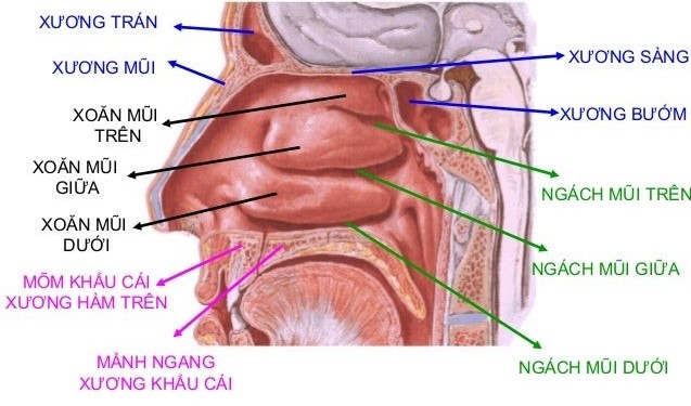 xoang_1_1