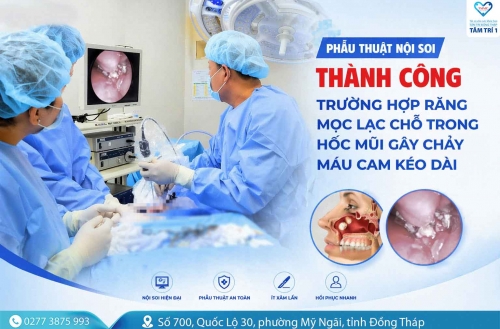 Phẫu thuật nội soi thành công trường hợp răng mọc lạc chỗ trong hốc mũi gây chảy máu cam kéo dài