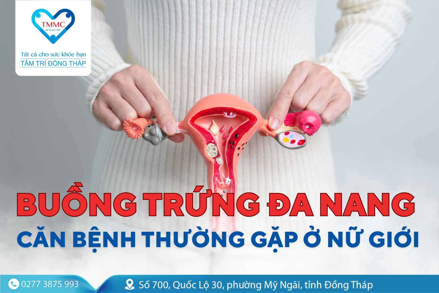 Buồng trứng đa nang: Căn bệnh thường gặp ở nữ giới