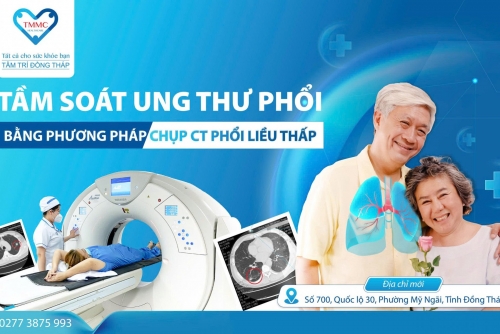 Tầm soát ung thư phổi bằng phương pháp chụp CT phổi liều thấp tại Tâm Trí Đồng Tháp