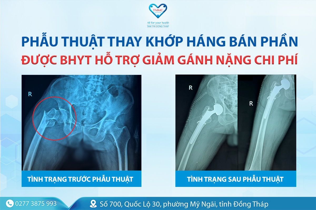 THUMB_thay_khYp_YYYc_hYYng_BHYT