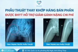 Phẫu thuật thay khớp háng bán phần được BHYT hỗ trợ, giảm gánh nặng chi phí cho người bệnh