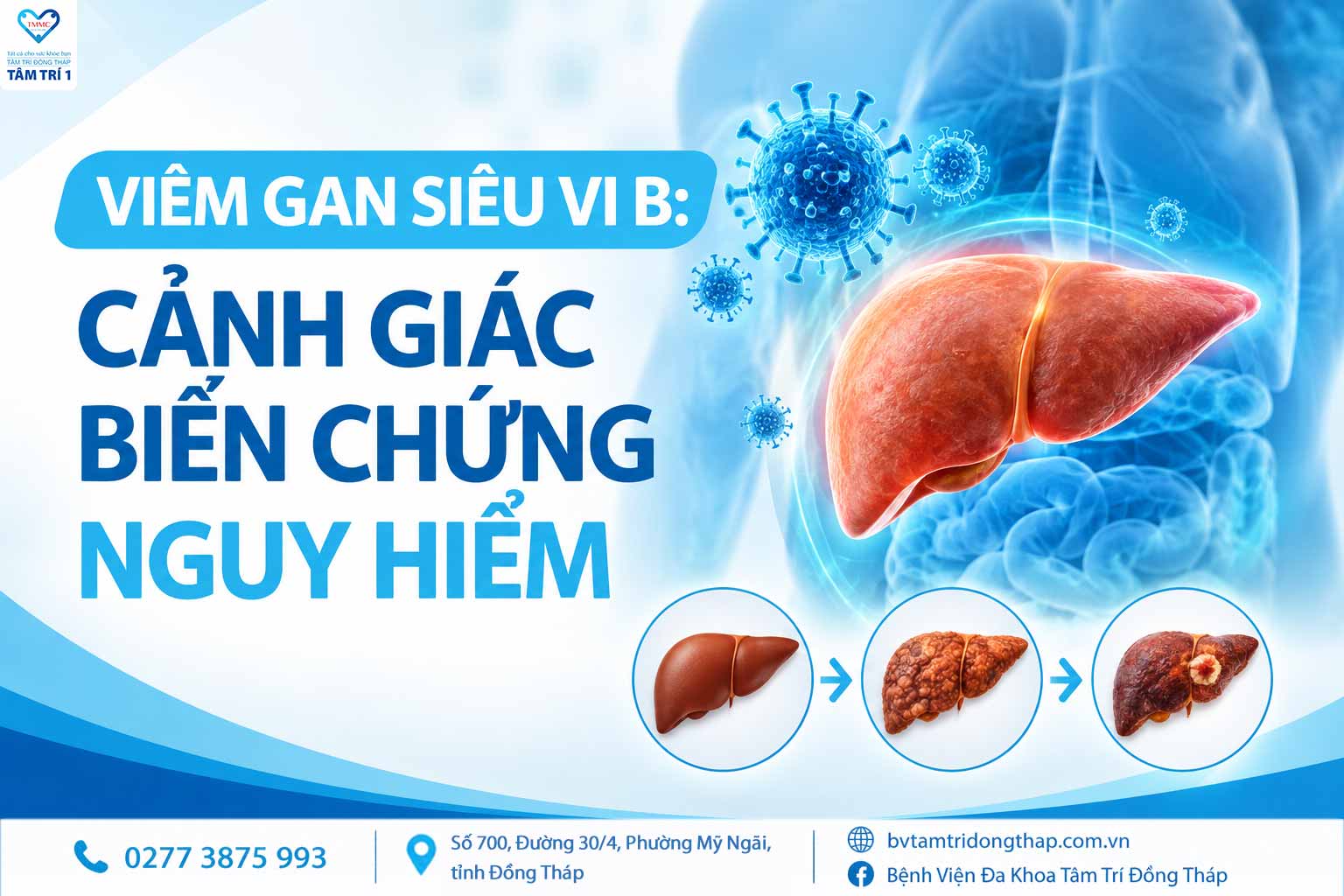 Viêm gan siêu vi B: Cảnh giác nguy cơ và biến chứng
