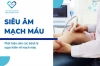 Siêu âm mạch máu phát hiện sớm các bệnh lý nguy hiểm về mạch máu