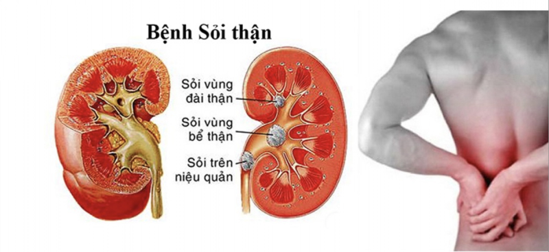 benh-soi-than