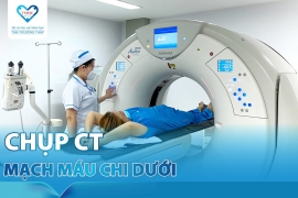 Chụp CT mạch máu chi dưới