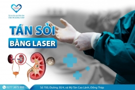 Tán sỏi bằng laser