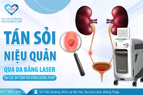 Tán sỏi niệu quản qua da bằng Laser