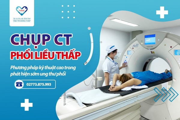 Chụp CT liều thấp, giải pháp tối ưu phát hiện sớm ung thư phổi